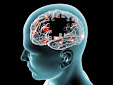 Dementia & Neurology Webinar 2022